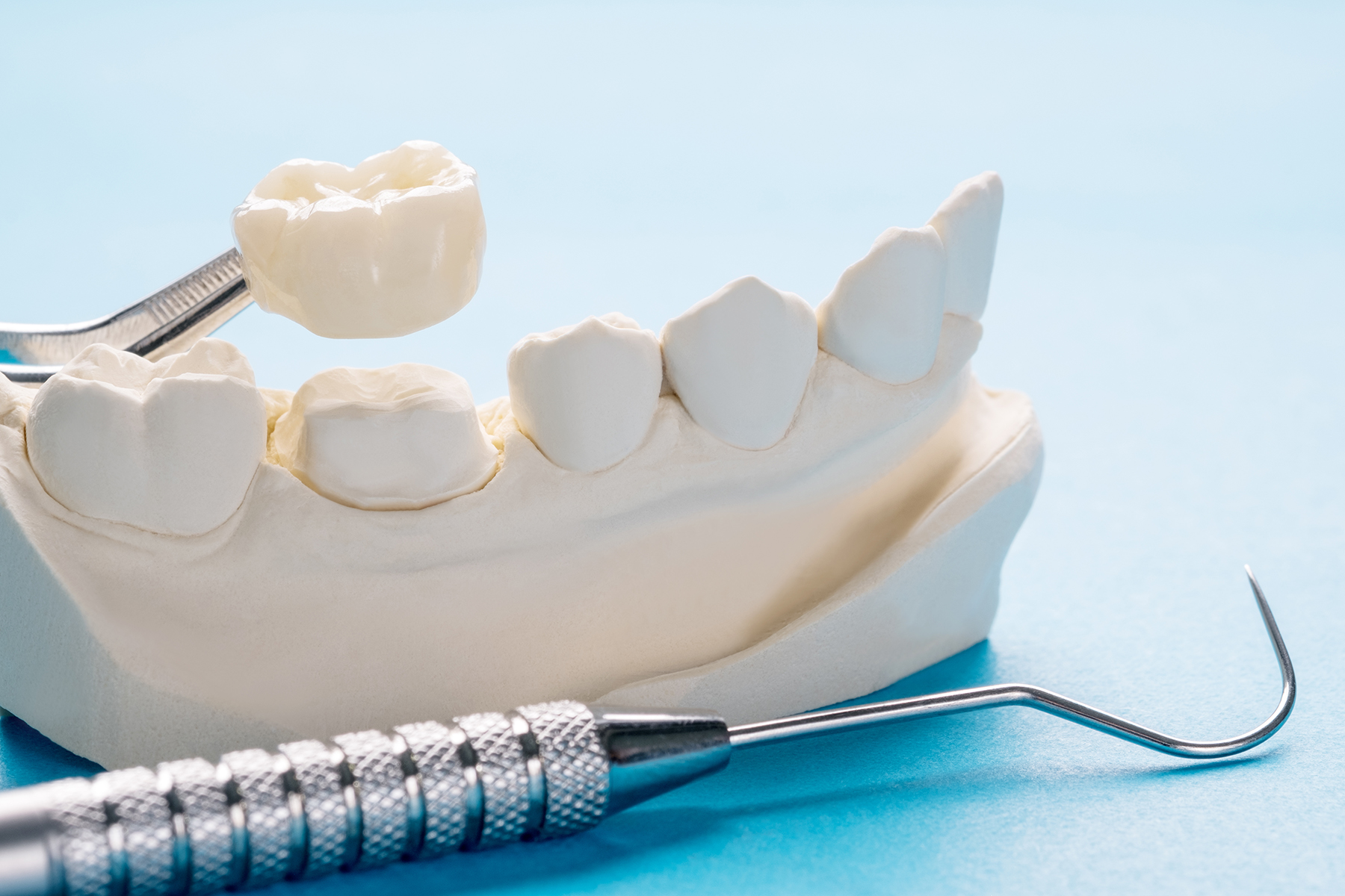 Dental crown restorations in Wareham, MA