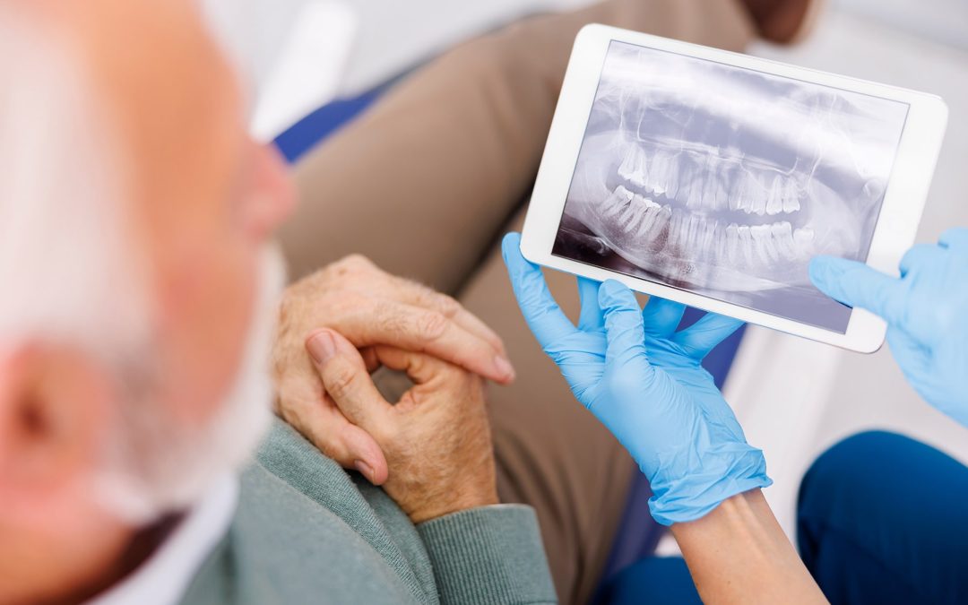 How Seniors Can Maintain Their Oral Health and Manage Dental Costs